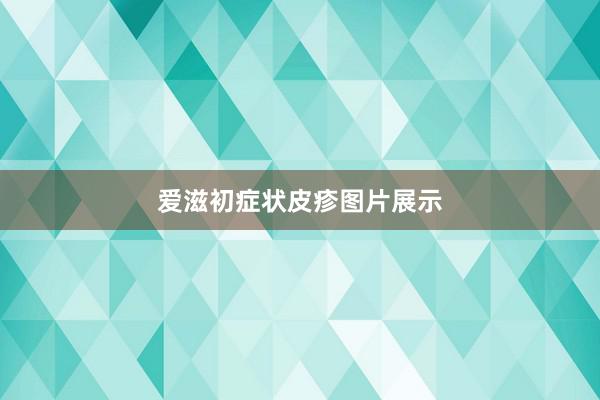 爱滋初症状皮疹图片展示